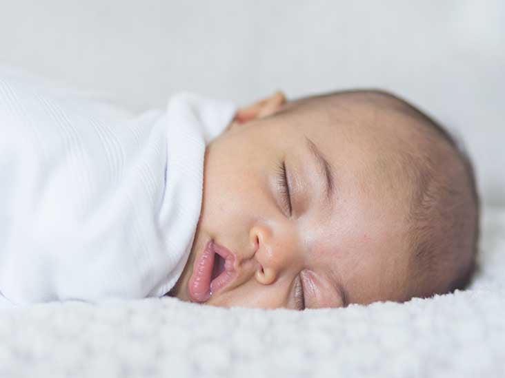 Baby Acne Causes, Symptoms, and Treatment