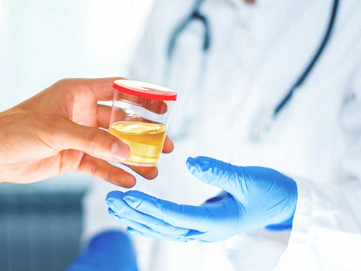 urine test for prostate cancer markers ichthyol gyertyák és prosztatitis