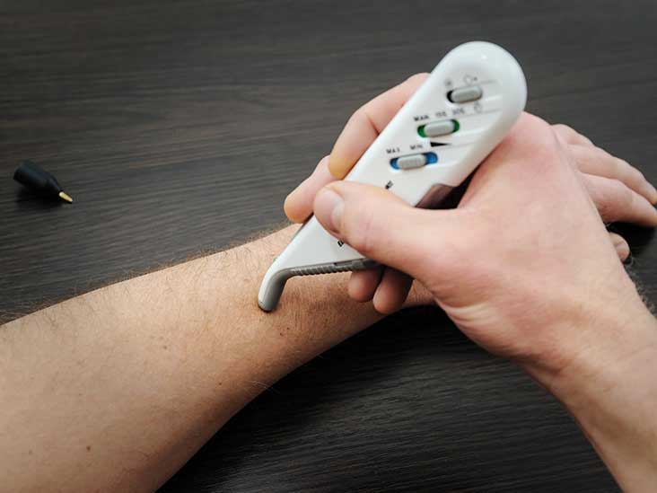 TENS Unit Definition & Patient Education