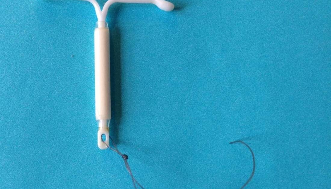 Breast cancer and Mirena IUD What's the link?