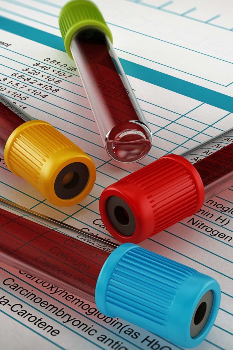 red-cell-distribution-width-rdw-blood-test-what-is-it