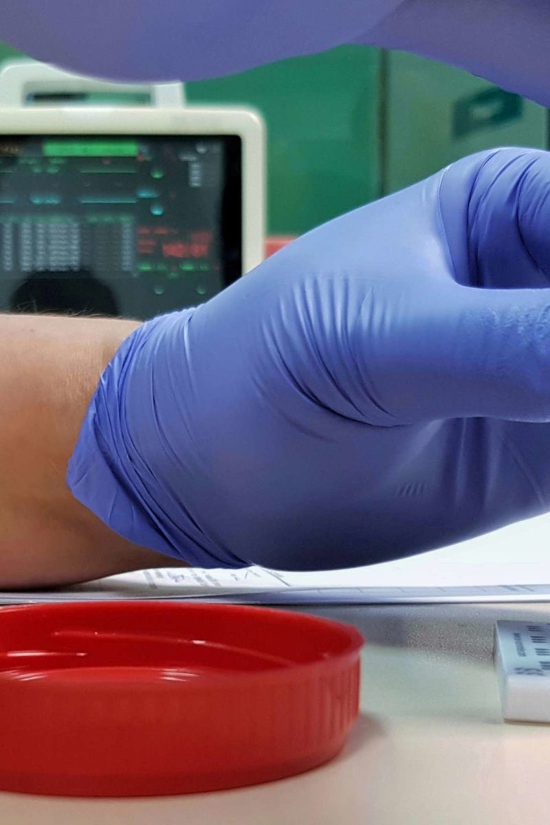 Urine drug screen Uses, procedure, detection times, and results