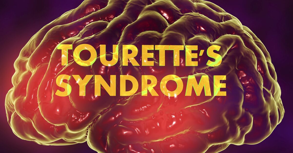 Promising New Treatment for Tourette Syndrome