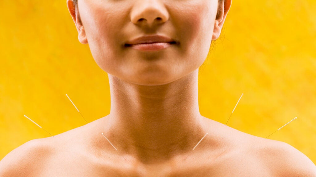 Acupuncture for Depression Effectiveness and Points Psych Central